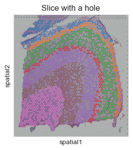 ../_images/tutorials_T2-imputation-and-super-resolution_17_1.png